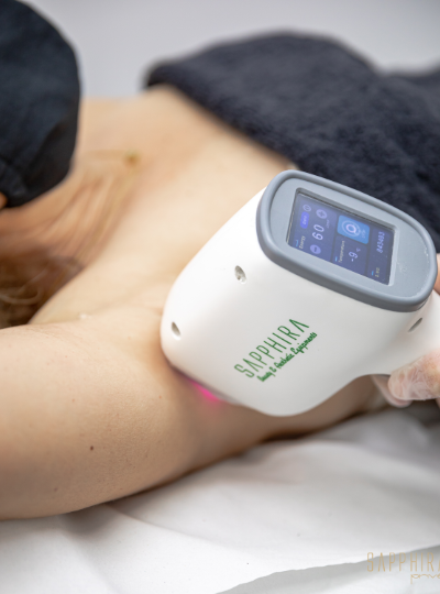 Depilación Láser Femenina